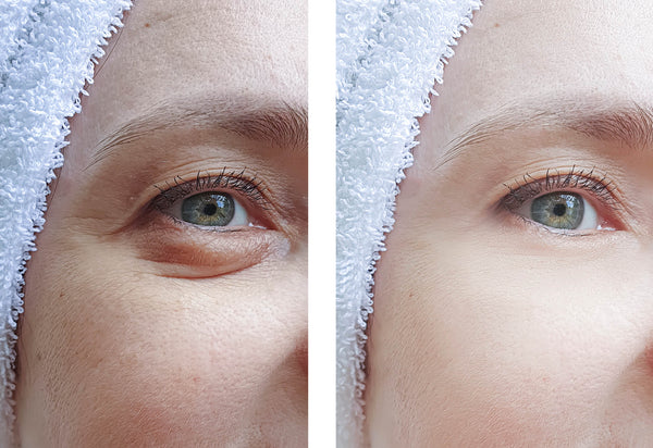 How to Reduce Puffy Eyes - Luma by Laura